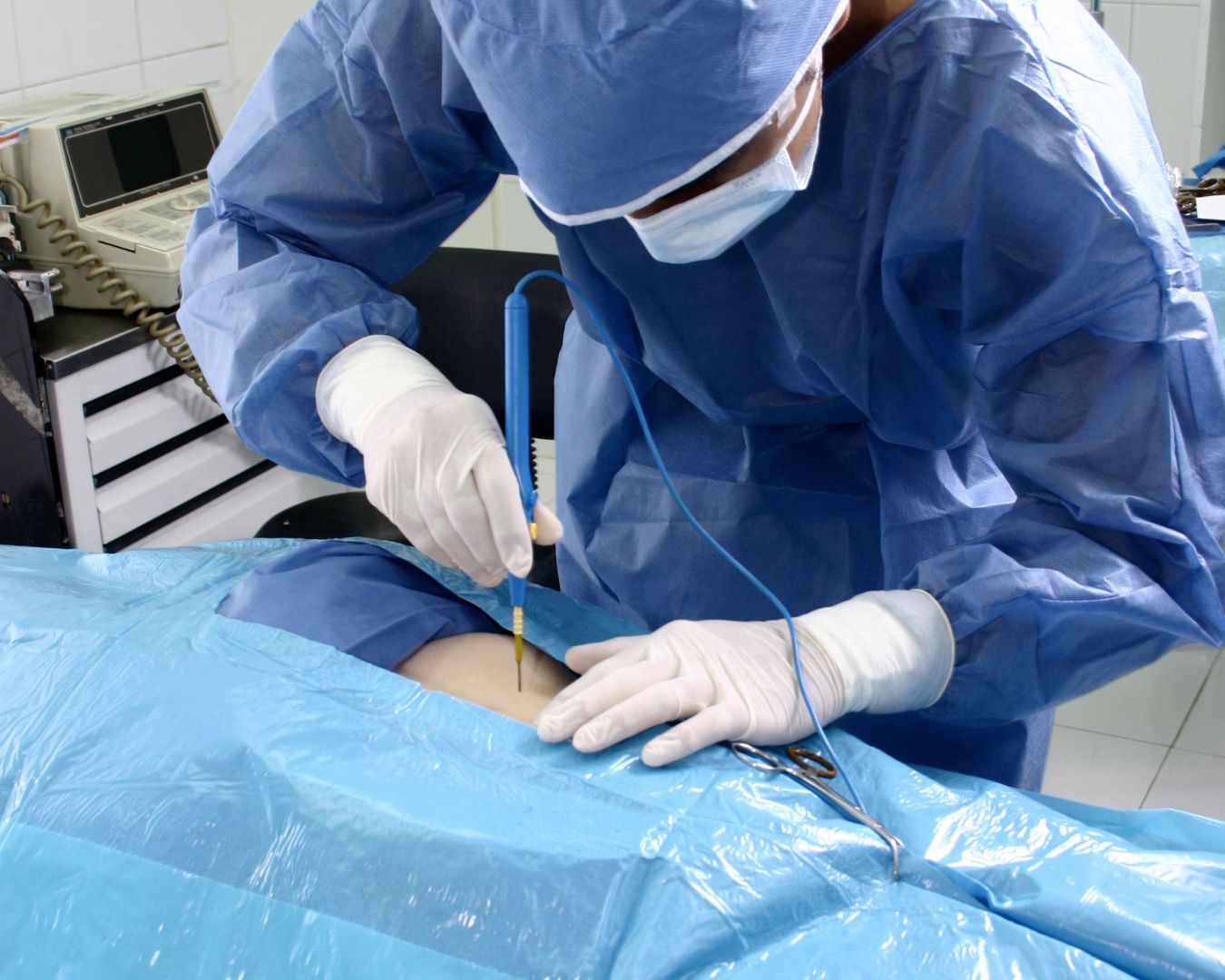 Procedimiento quirúrgico